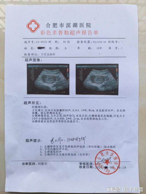 人流有痛和无痛哪个好无痛人流手术北京的无痛人流后要注意些什么