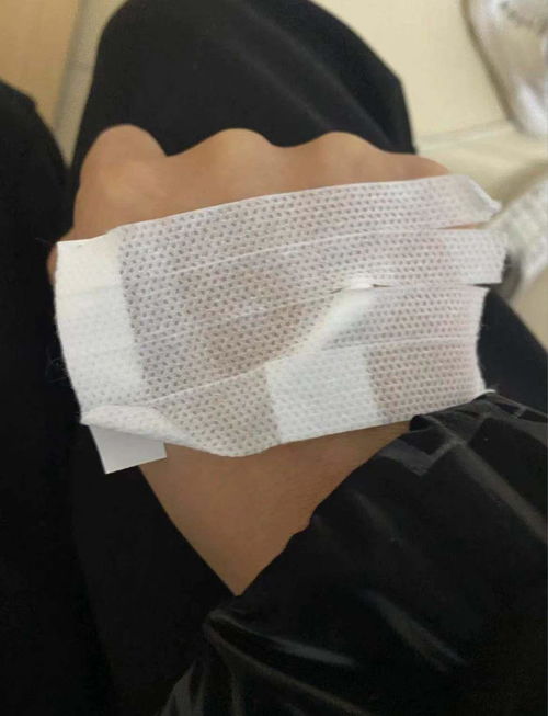重庆医院无痛人流手术过程,讲述一下我的全部吧